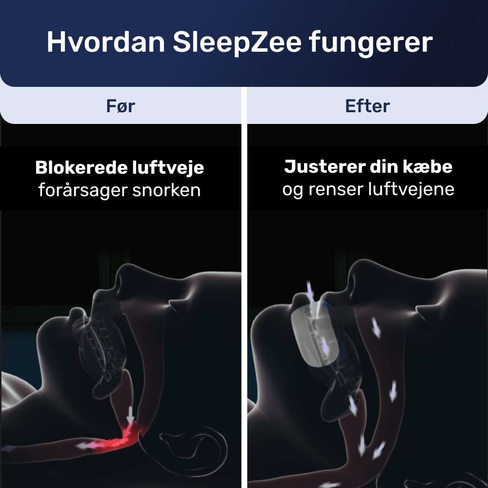 SleepZee image