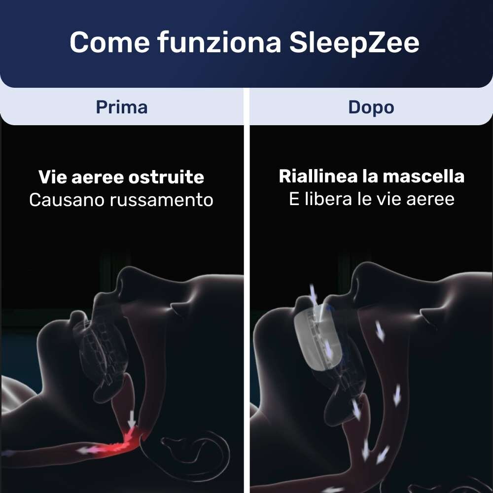 SleepZee image