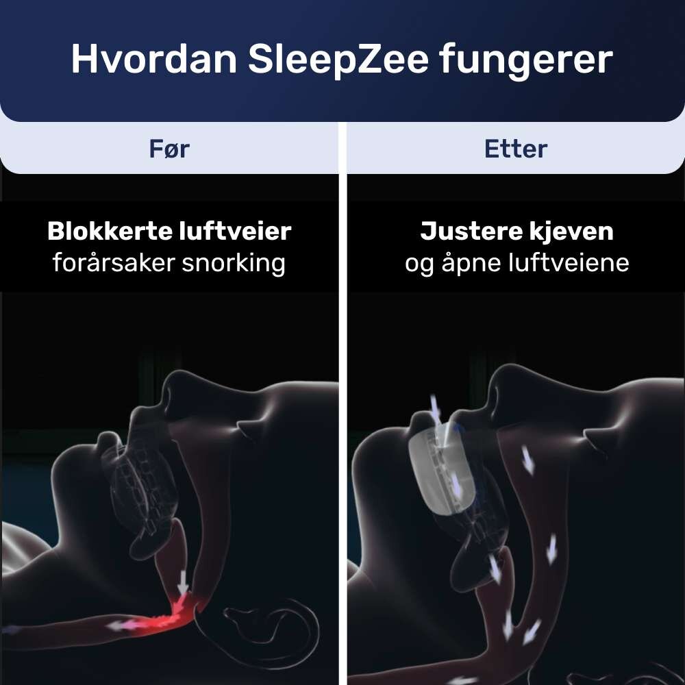SleepZee image