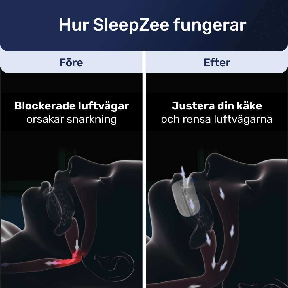 SleepZee image